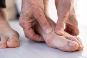 Bunions Treatments in Houston for People Who Are Tired of Choosing Shoes around Foot Pain